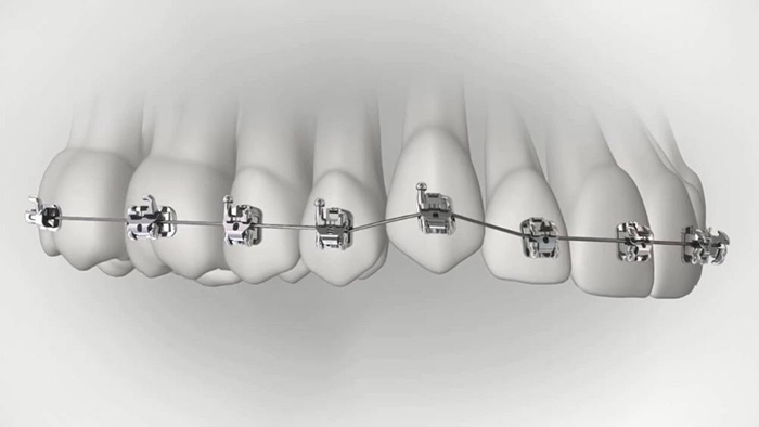 承德市哪家口腔醫(yī)院口腔正畸做得好？惟德口腔醫(yī)院來告訴您