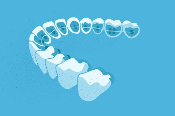 惟德口腔醫(yī)院口腔正畸好不好？